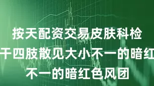 按天配资交易皮肤科检查：躯干四肢散见大小不一的暗红色风团